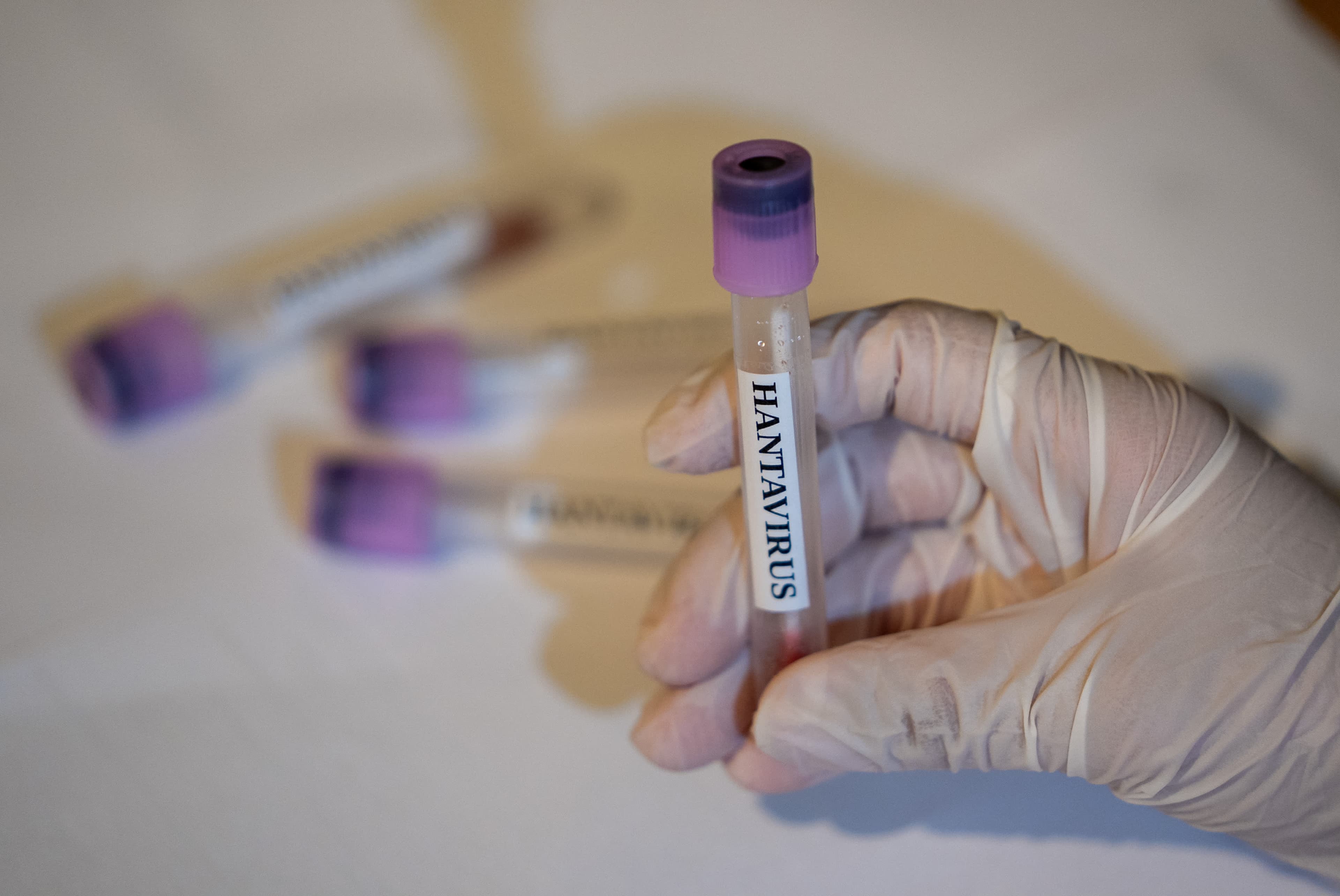 CDC Monitors 41 for Hantavirus; Public Risk Remains Low